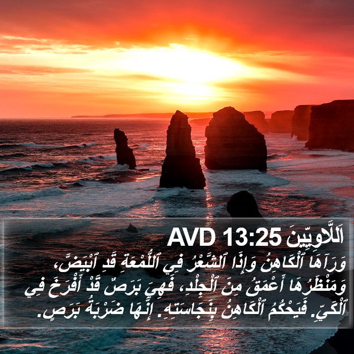 اَللَّاوِيِّينَ 13:25 AVD Bible Study