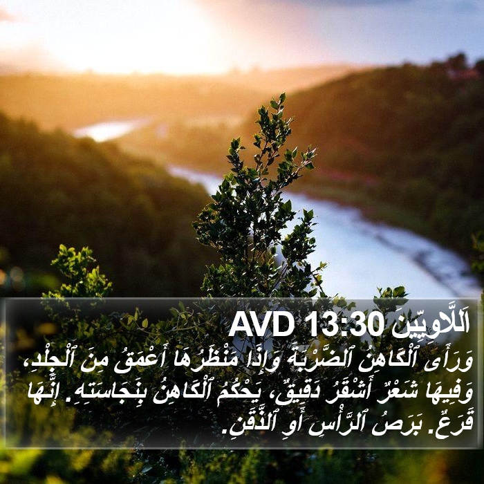 اَللَّاوِيِّينَ 13:30 AVD Bible Study