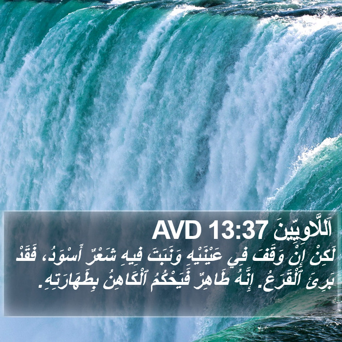 اَللَّاوِيِّينَ 13:37 AVD Bible Study