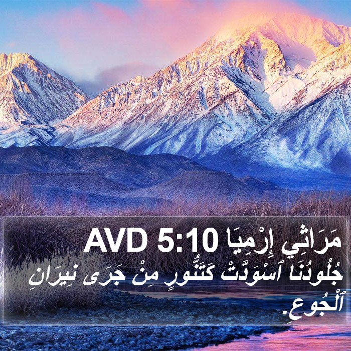 مَرَاثِي إِرْمِيَا 5:10 AVD Bible Study